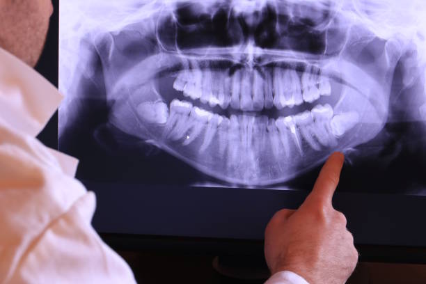 Best Walk-In Emergency Dentist in Vinton, LA