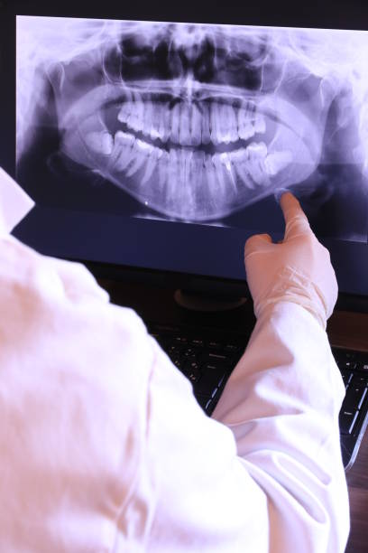 Best Emergency Tooth Extraction in Vinton, LA