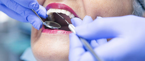 Best Emergency Broken Tooth Repair in Vinton, LA